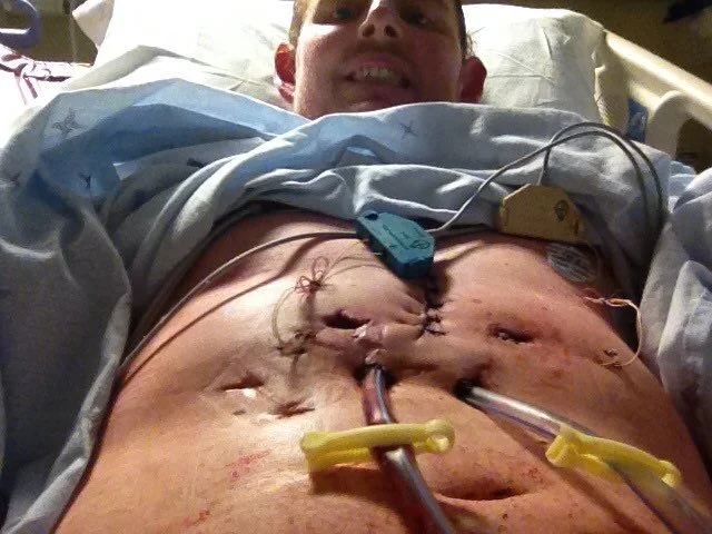 Why do I train? Why do I do jujitsu? This is a day or so after transplant. God enabled this. He gave me the power to over come.