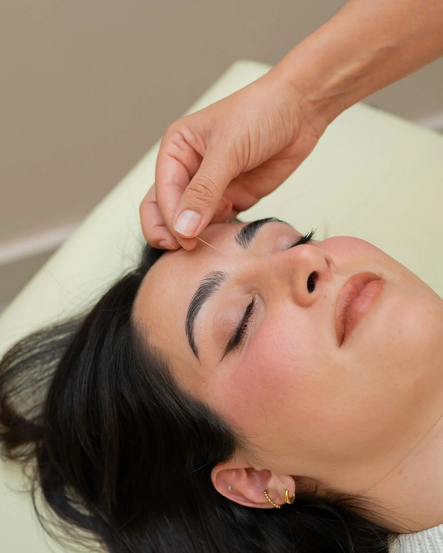 Toronto weather is really doing the most right now&hellip;
Sun ➡️ rain ➡️ cold ➡️ warm ➡️ repeat 

If your body feel as all over the place as the forecast, you&rsquo;re not alone. 

Acupuncture helps regulate your system, ease tension, and bring you 