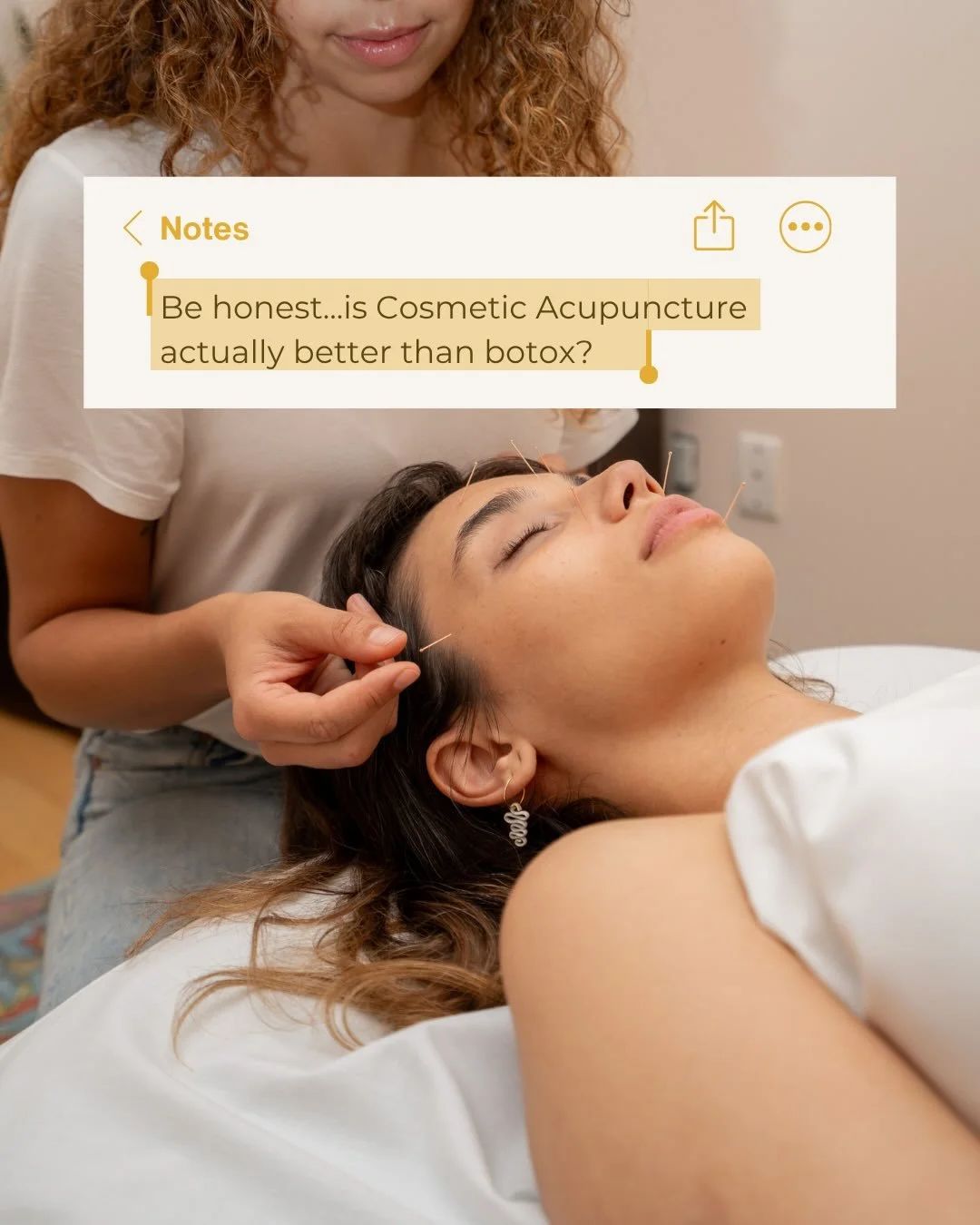 When it comes to glowing skin, Jessica knows her stuff! 

Visit Jessica for Cosmetic Acupuncture to get naturally glowing skin by this summer. The perfect way to treat yourself, reduce signs of aging, and manage discolouration by stimulating your bod