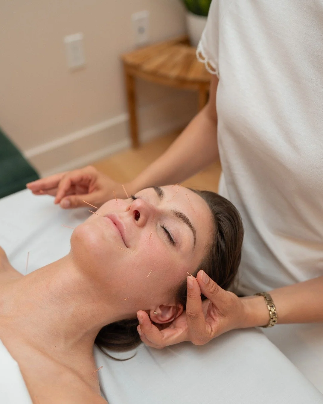 Facial acupuncture, up close 🌿

Cosmetic acupuncture uses ultra-fine needles to support circulation and release tension in the face. It&rsquo;s a gentle, natural way to care for your skin.

What people often love:
✨ A fresh, glowing look
✨ Softer-lo