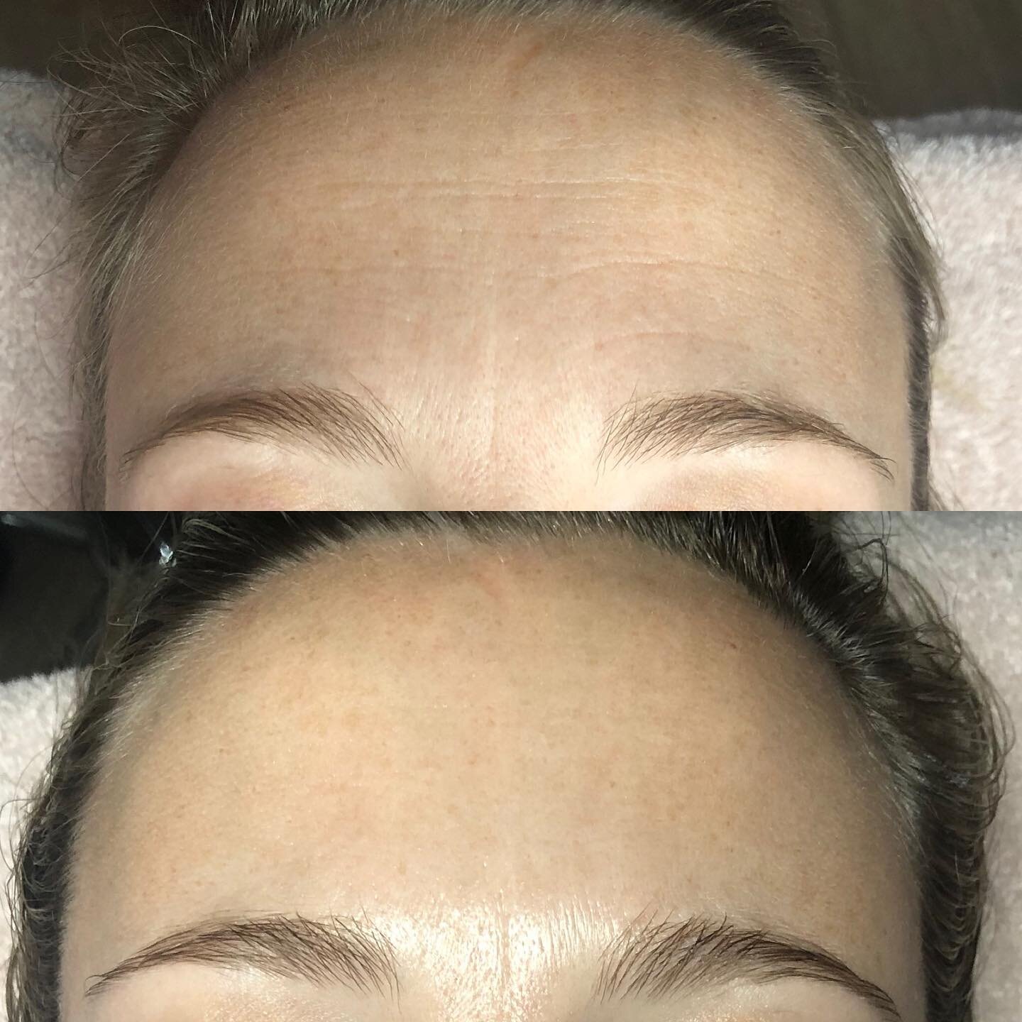 😍 Sculptural facelifting is amazing at bringing life back to tired skin 👏🏼 It&rsquo;s not just about the buccal 😉 

#bespokefacialsgeelong #sculpturalfacelifting #buccalfacialgeelong #buccalmassage #slowbeautifulskin #healthyskin #bespokefacialsg