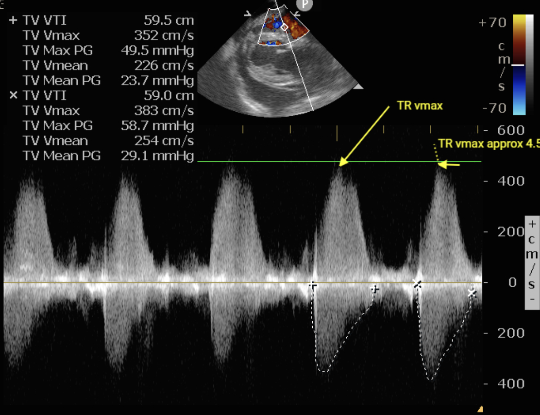 Pulmonary Hypertension in Companion Animals: Practical Diagnostic and Treatment Guidelines