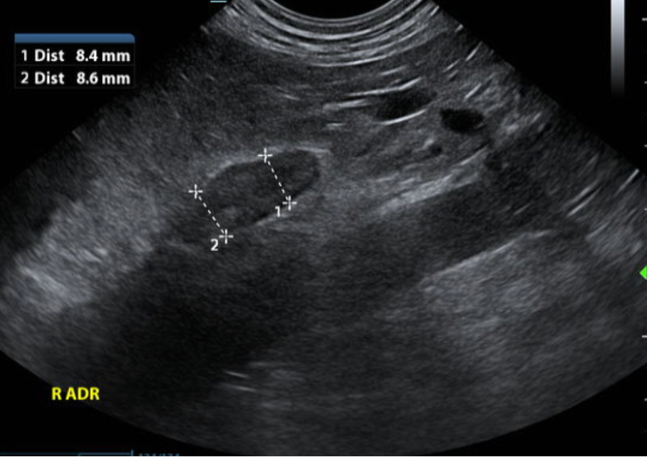10 Tips From a Specialist  for Better Diagnostic Abdominal Ultrasounds in Practice