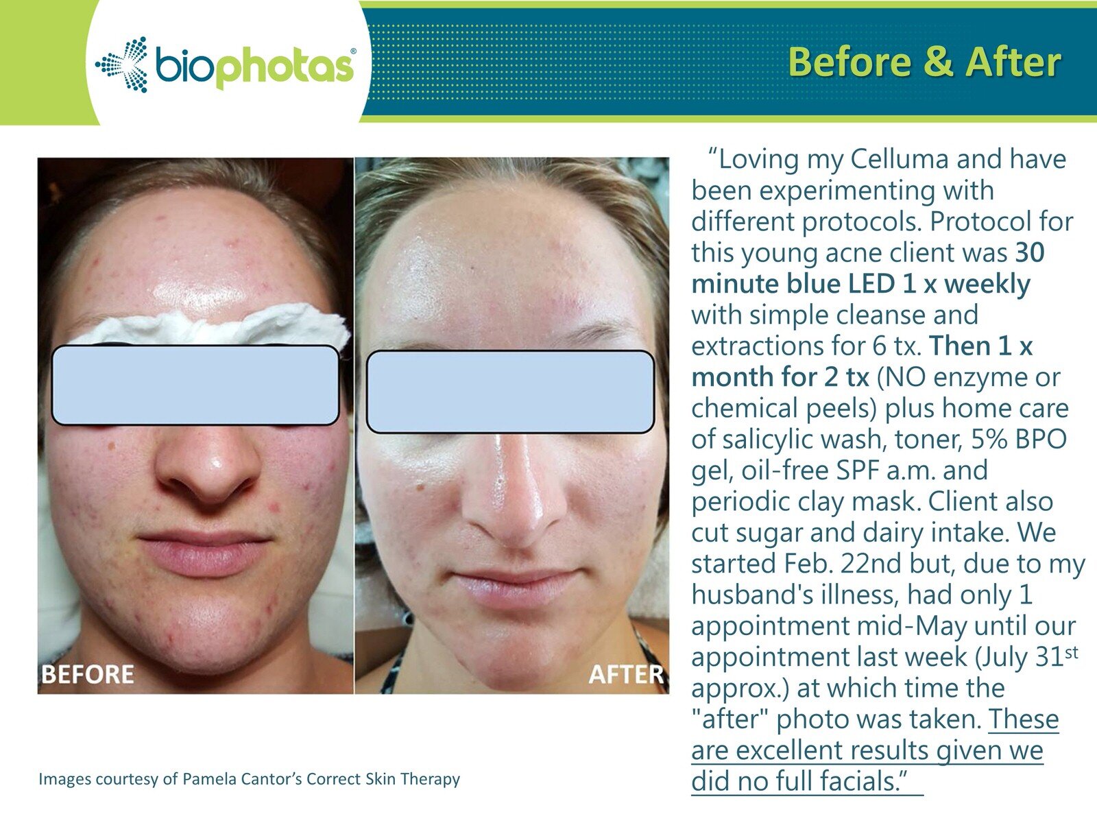 Before-After Celluma LED Light Therapy (7).JPG