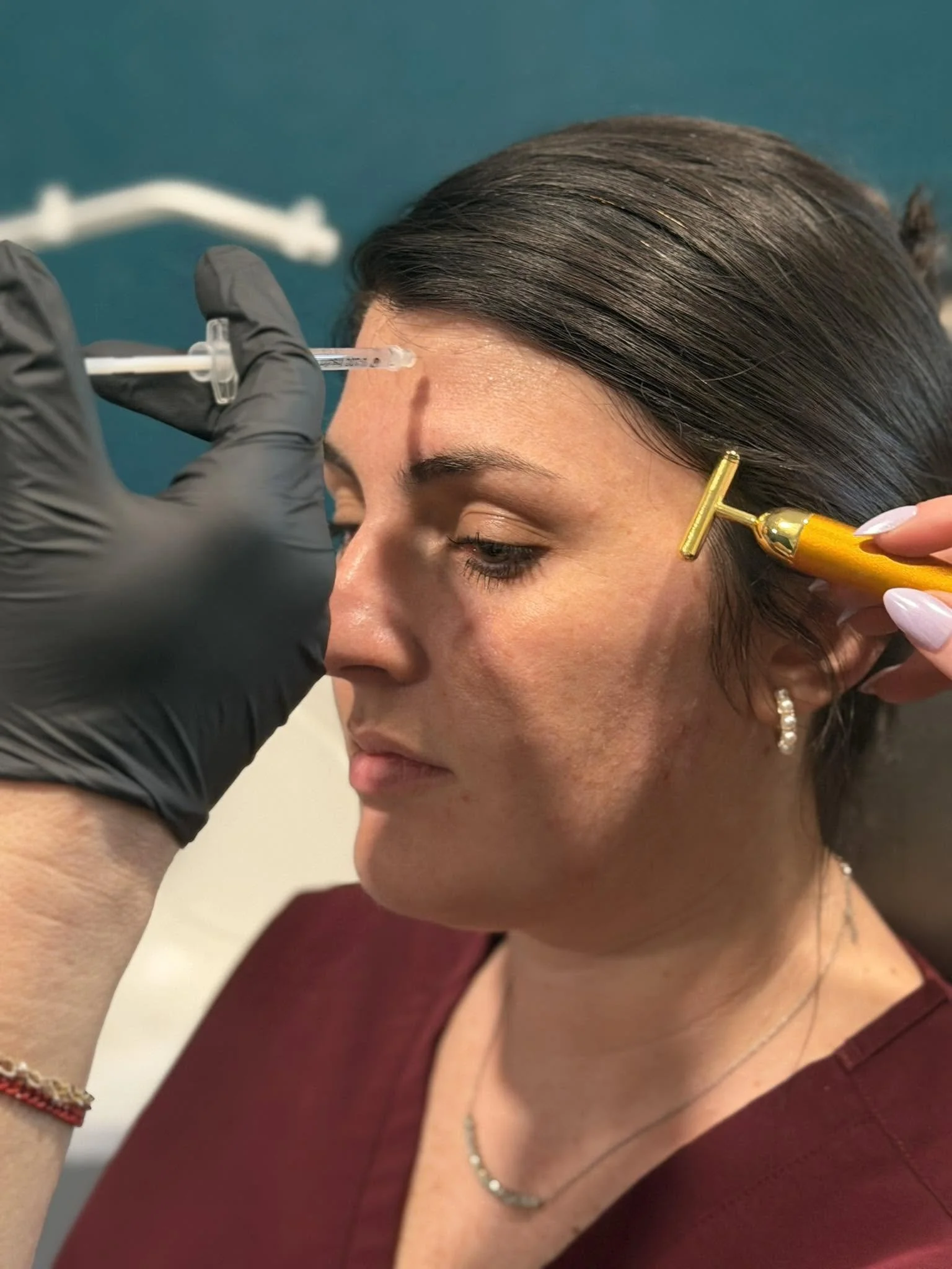 A person receiving a cosmetic injection near the eyebrow from a healthcare professional wearing black gloves.