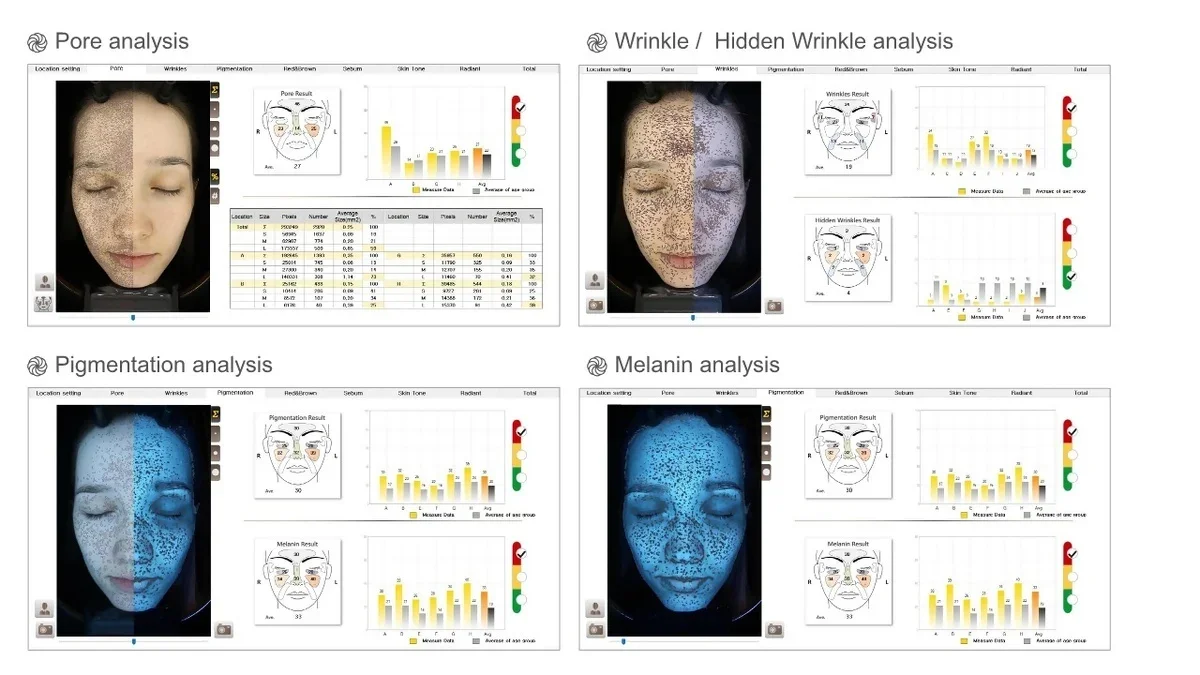 Analysis 1.jpg.webp
