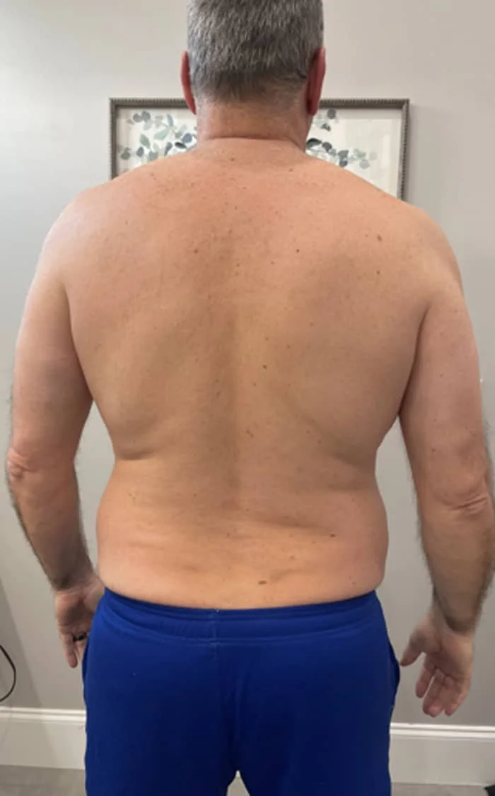 BACK AFTER