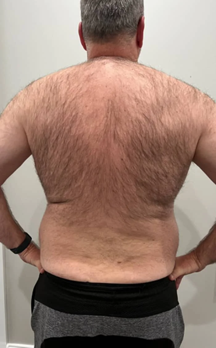BACK BEFORE
COURTESY OF ANEW AESTHETICS