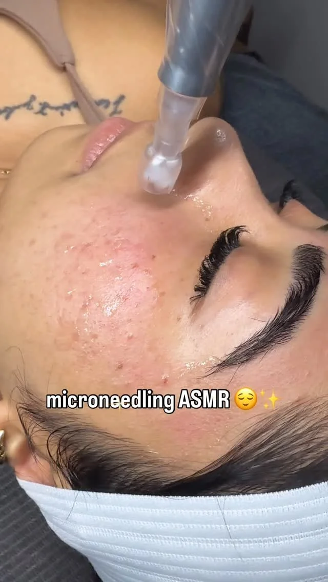 There’s something about the relaxation of white noise during a microneedling session… ✨😌 Have you tried microneedling yet?? Your skin will thank you 😍 Whether you just need a refresh or have scarring or hyperpigmentation, you know wher