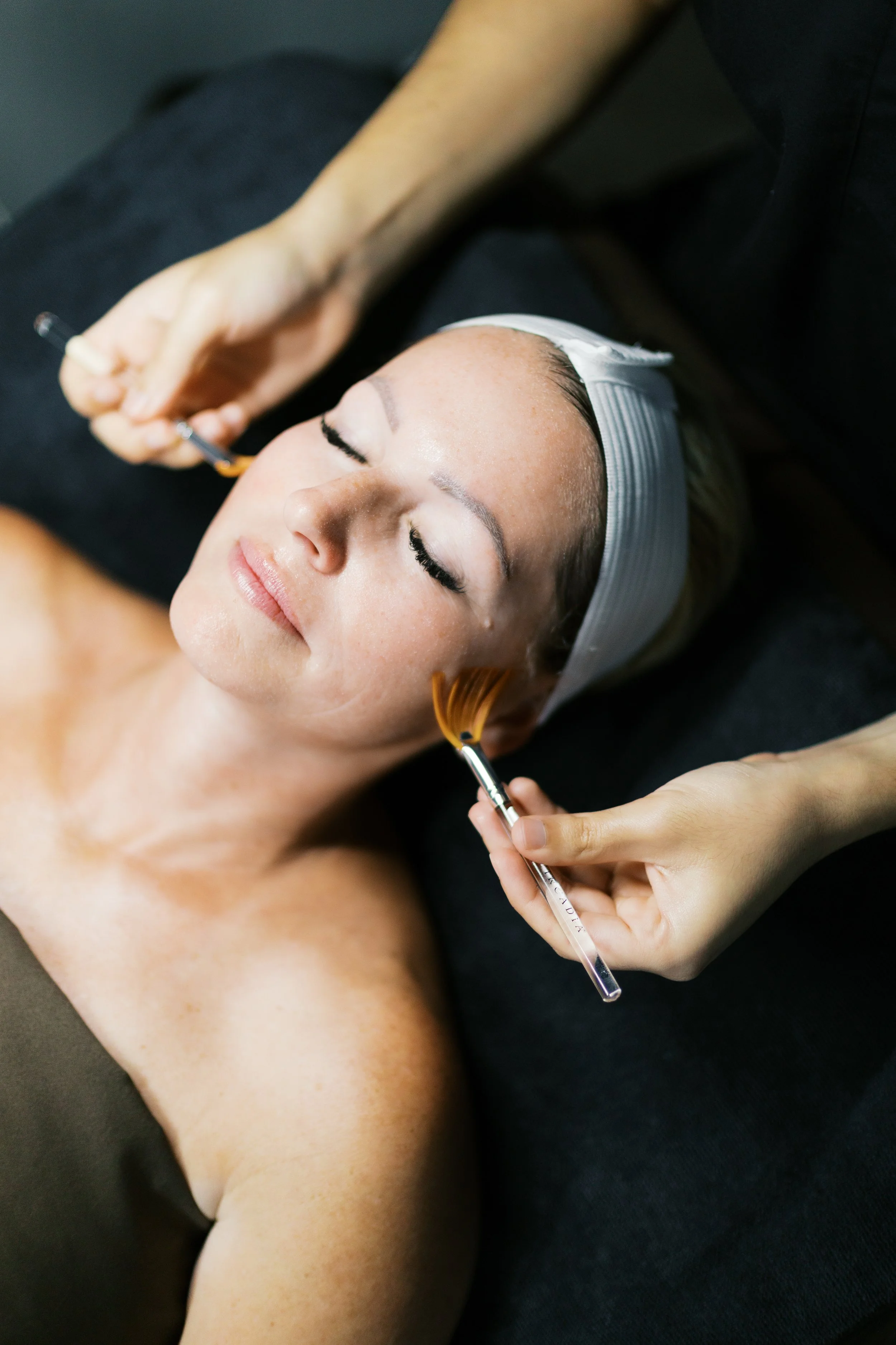 The Face Space Studio - Microneedling Treatment