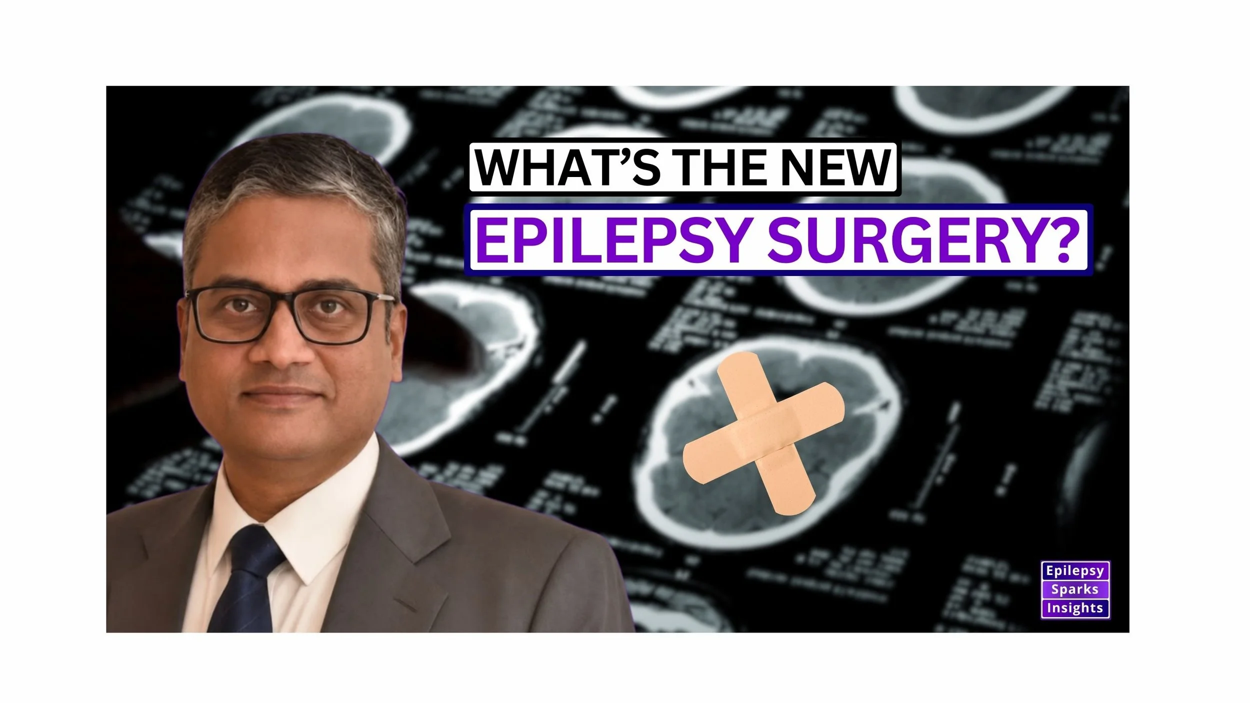       
  
     New Types of Epilepsy Surgery  - Prof. Sarat Chandra, All India Institute of Medical Sciences  What are some newer types of epilepsy surgery?! Today we hear about the new version called Robotic Thermocoagulative Hemispherotomy - for wh