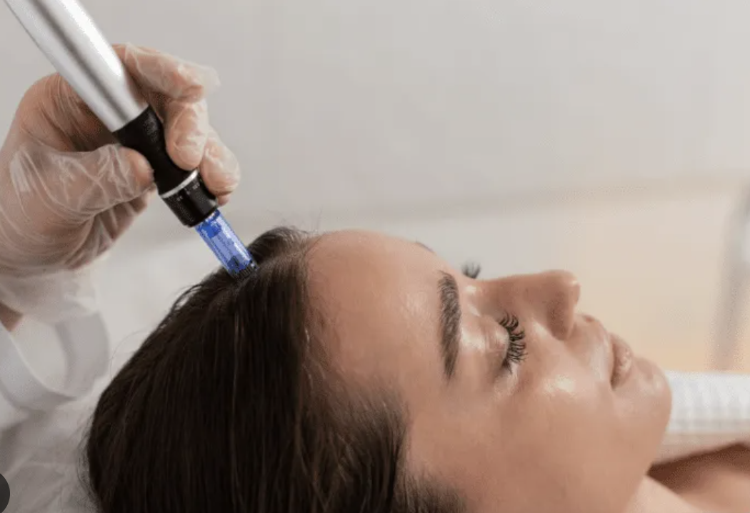 PRF Hair Regeneration