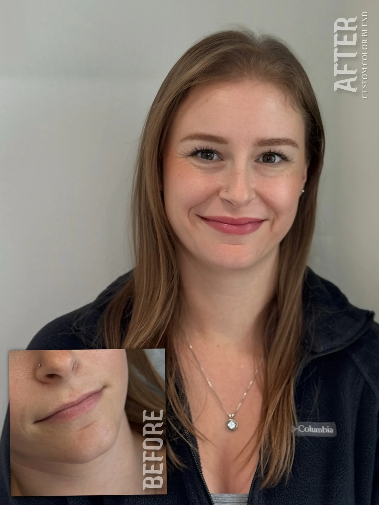 𝐒𝐨𝐟𝐭, 𝐂𝐨𝐨𝐥, 𝐁𝐞𝐫𝐫𝐲 𝐓𝐨𝐧𝐞𝐝 𝐋𝐢𝐩𝐬. 🍓
Depending on your natural lip tone and goals, results may be achieved in one session, or gradually through color building, shape refinement, or neutralization before the final shade is perfected.