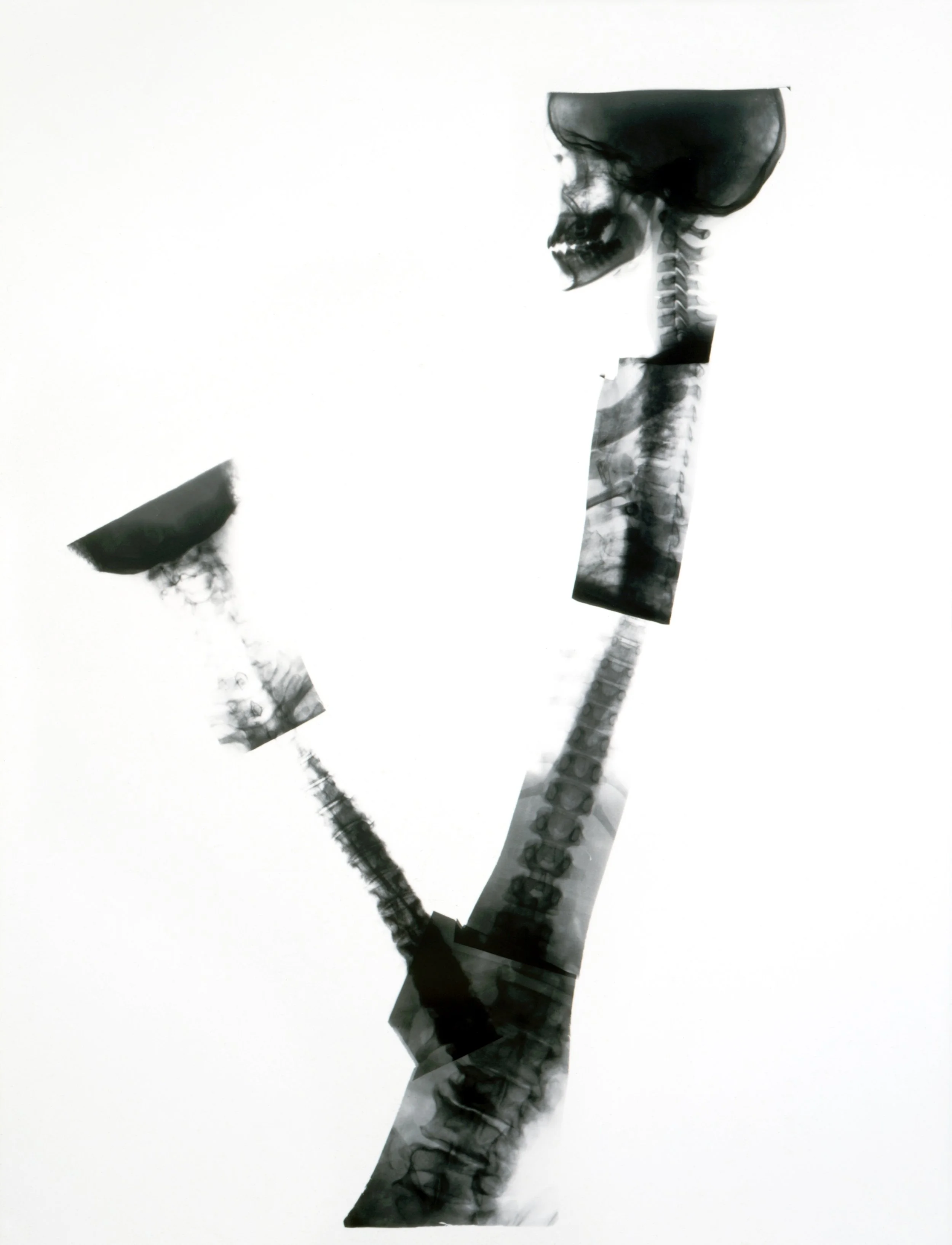 90s X-Ray