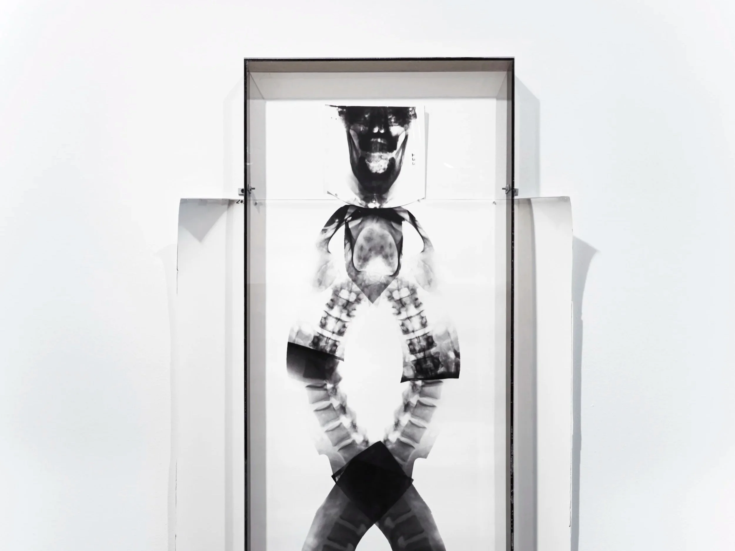 X-Ray