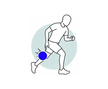 Line drawing of a person running and experiencing knee or leg pain.