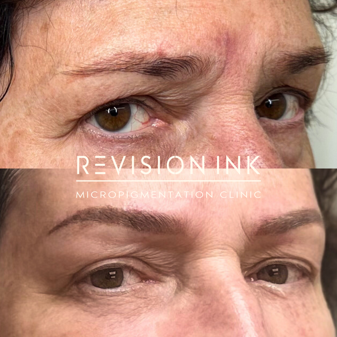 eyebrow b&a.png