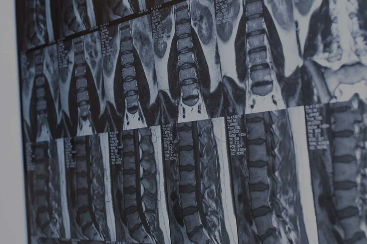 Facet Joint Injection