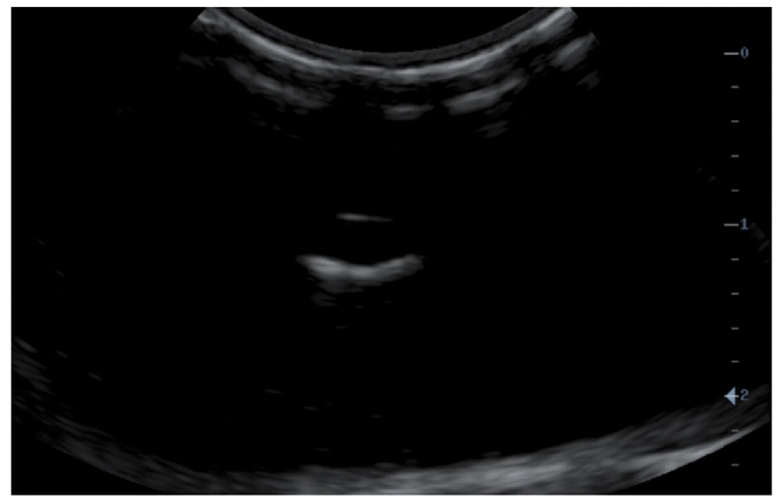 Ultrasound image of a ballistic gel phantom showing a Vascular scan.