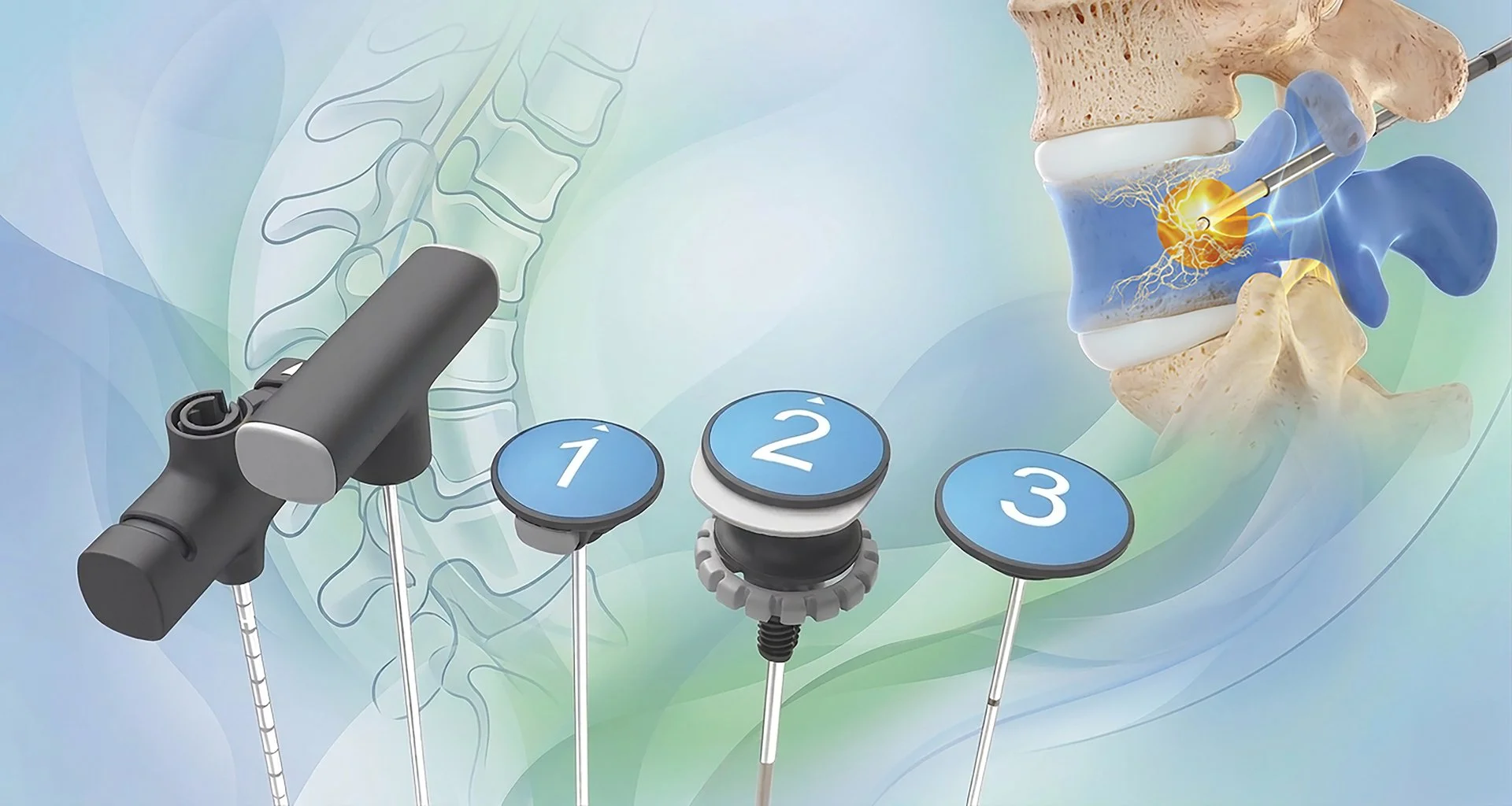 Boston Scientific Intracept System