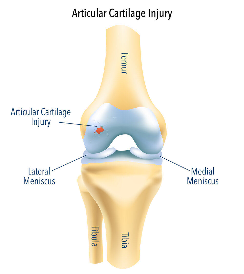 articular cartilage tratamentul artrozei articulațiilor degetelor de la picioare