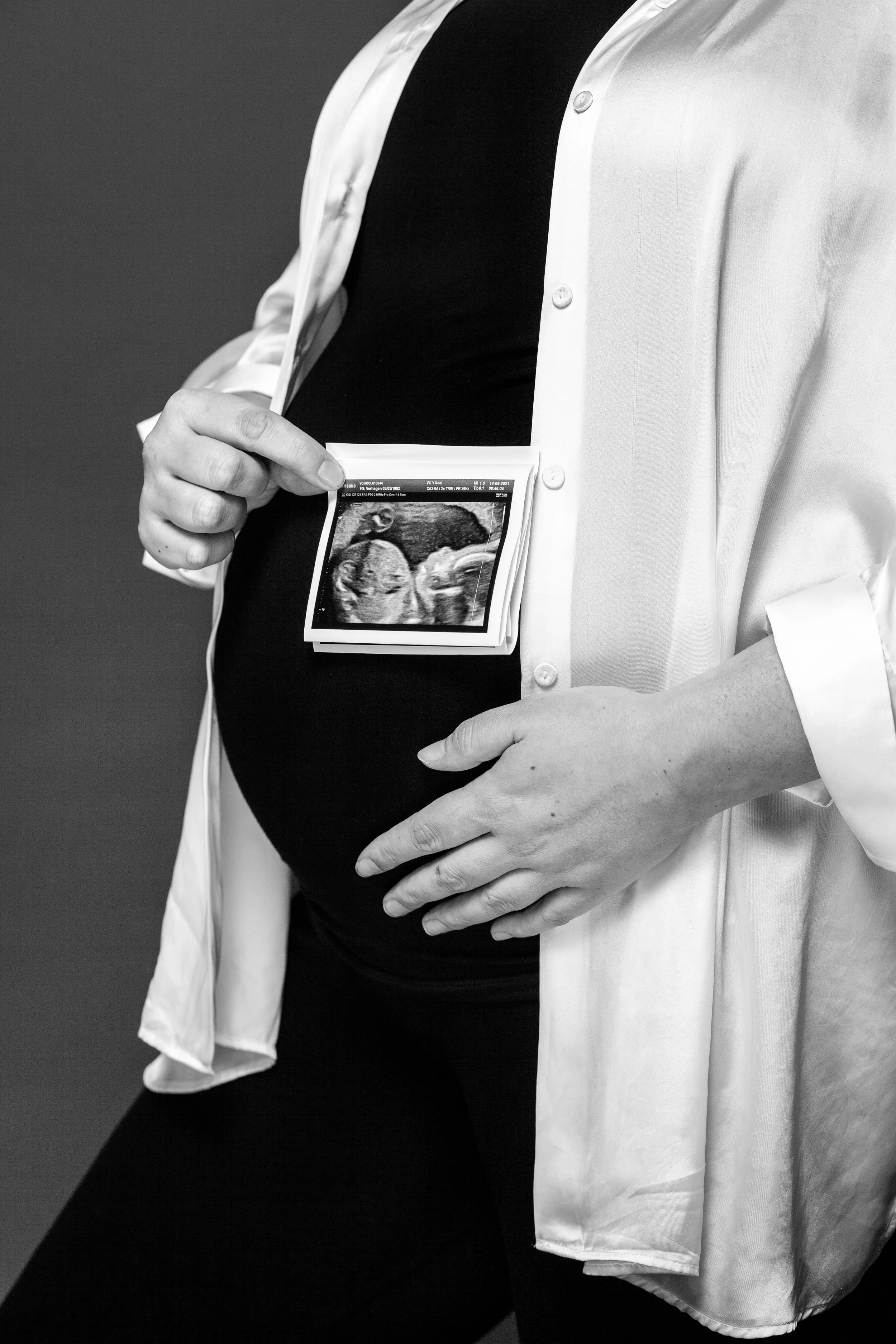 Een zwangere vrouw houdt een echografie in haar borst, zichtbaar onder haar bovenkleding.