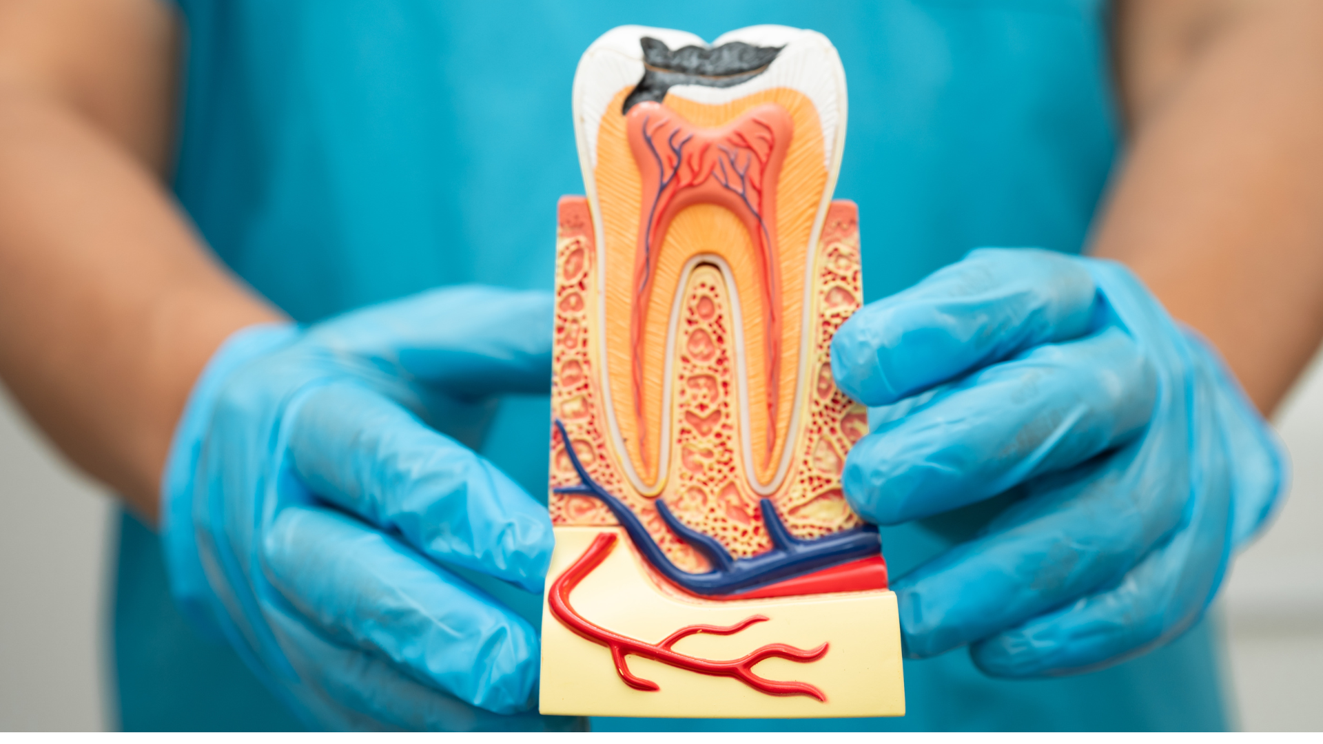 S3 Dental guide comparing root-canal treatment and tooth extraction