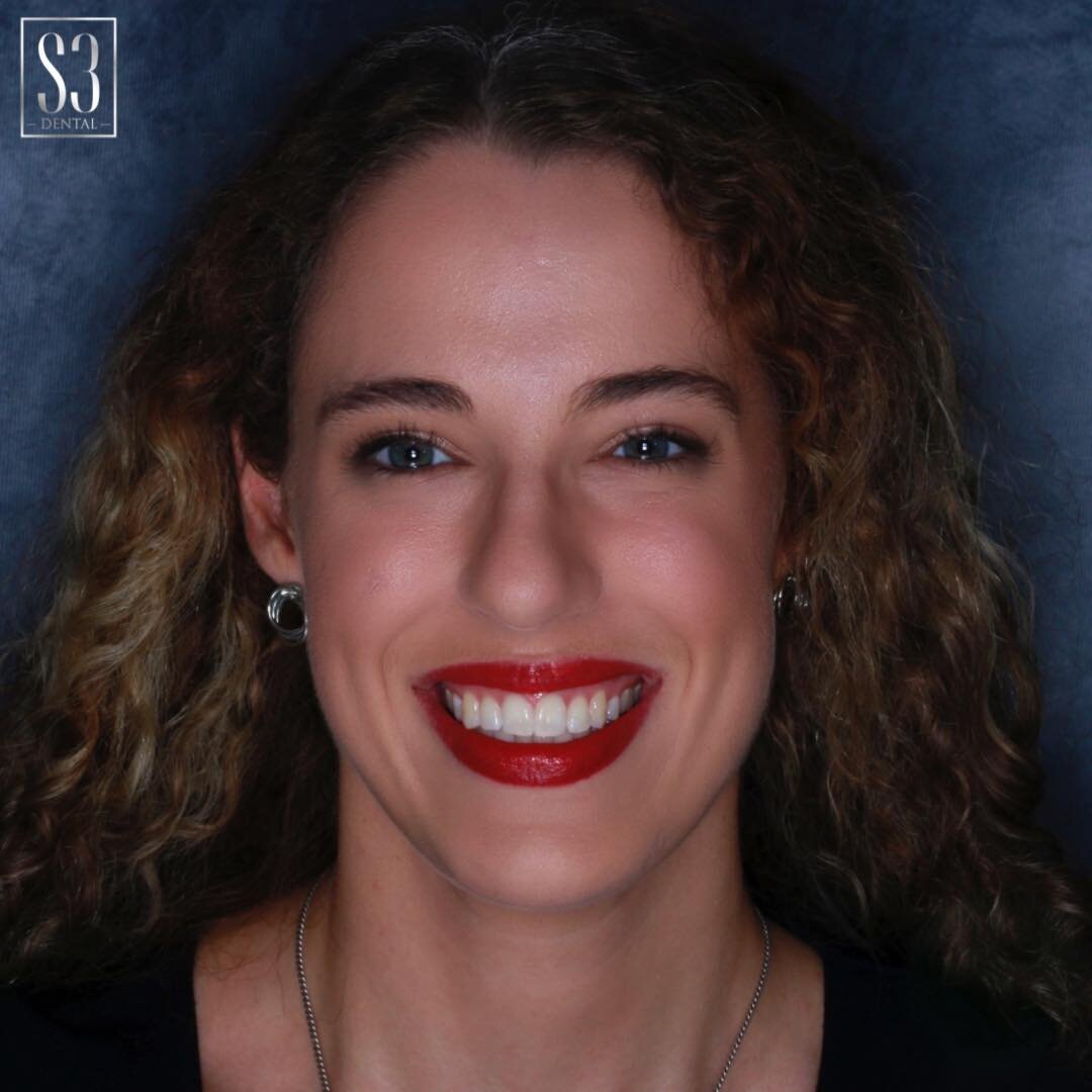 So excited to welcome Rebecca to S3 Dental!😁

Rebecca is a highly skilled dental therapist and hygienist. She has extensive healthcare experience as a previous registered nurse prior to becoming a dental therapist. 

Her extensive knowledge in healt