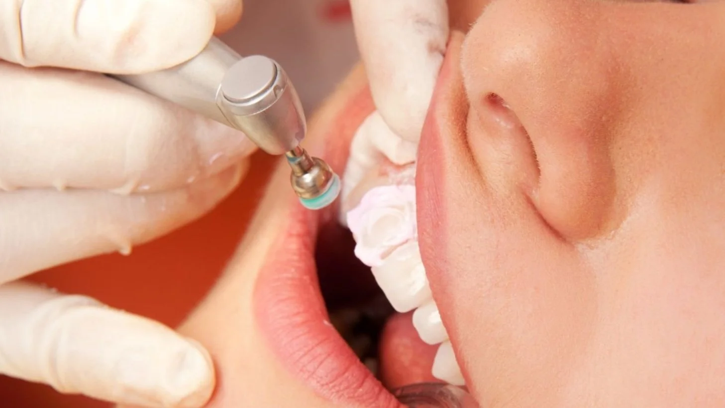 The Importance Of Healthy Gums