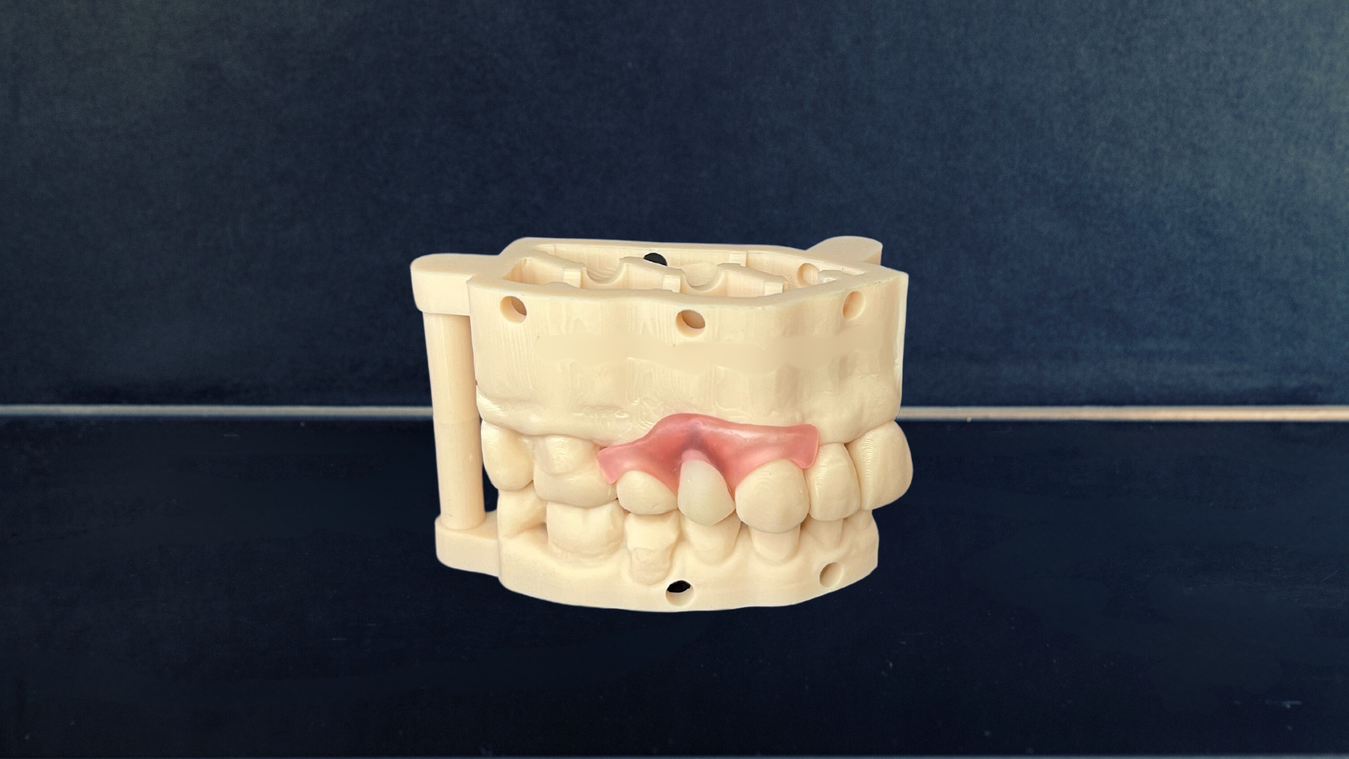 Digital Dentures: A Smile Revolution