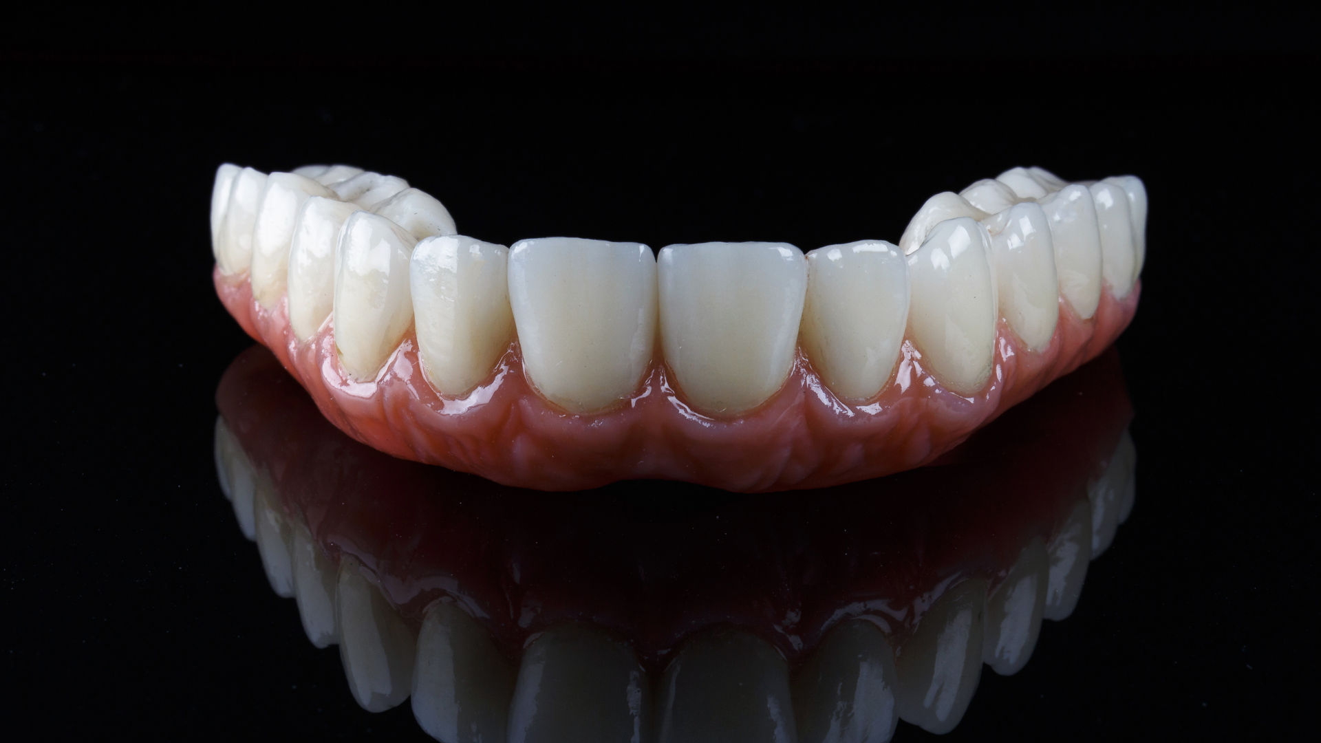 Full Mouth Dental Implants: A Comprehensive Guide