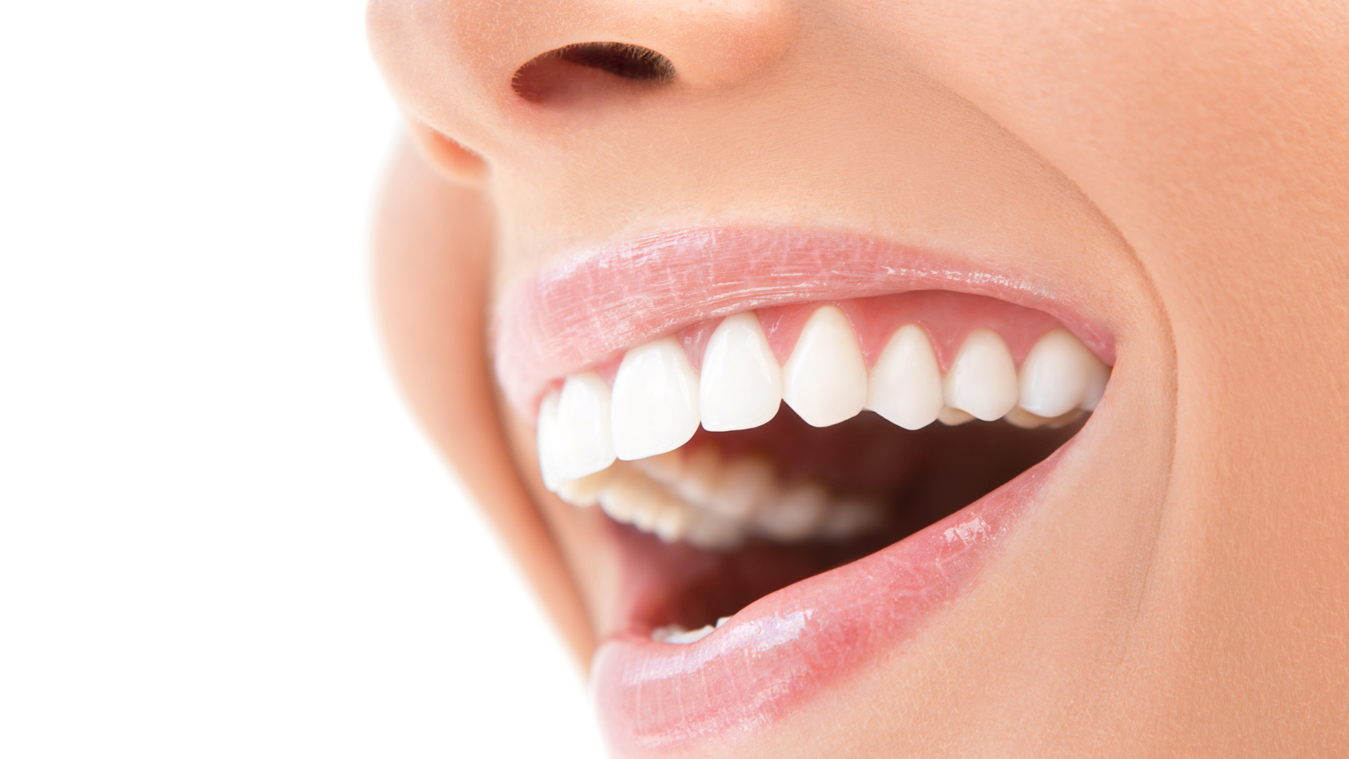 Natural-looking porcelain veneers and carefully planned cosmetic dentistry