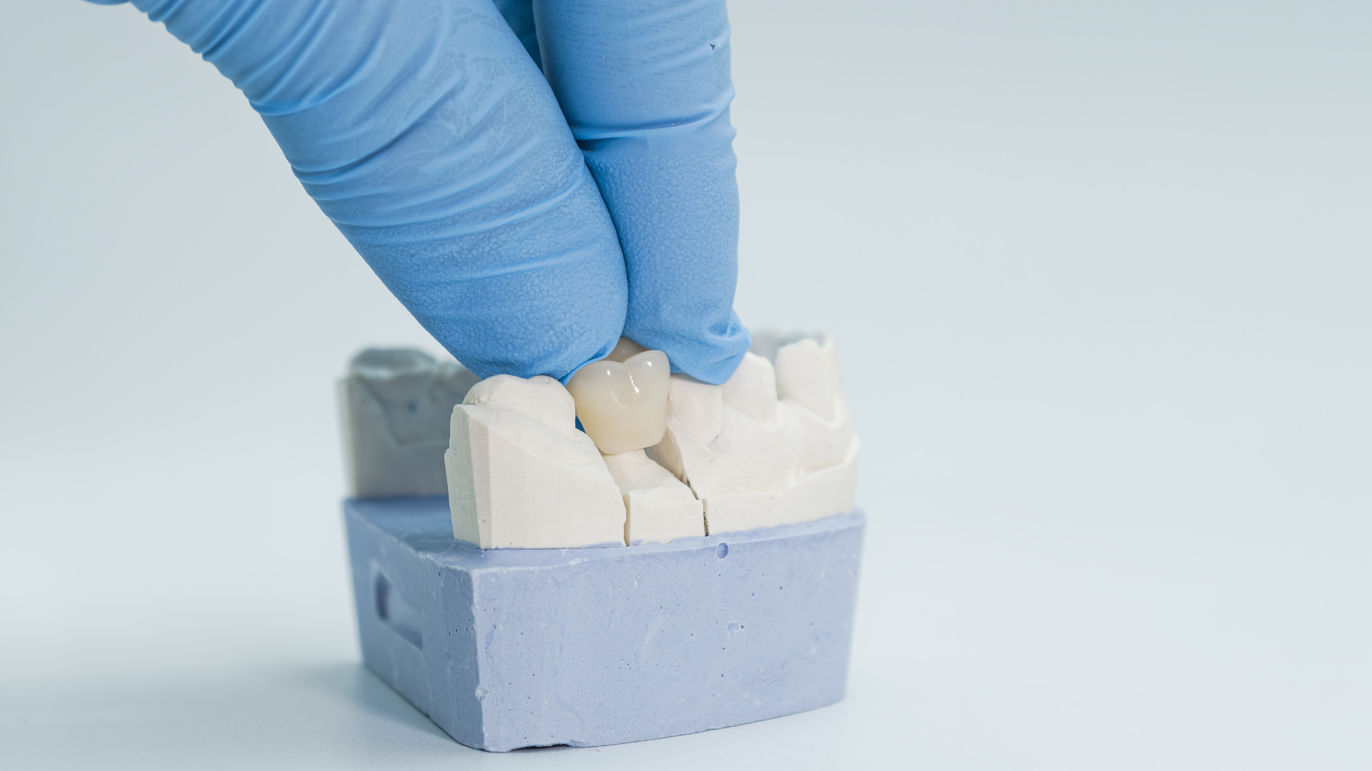 Same-day dental crowns and digital restorative dentistry at S3 Dental