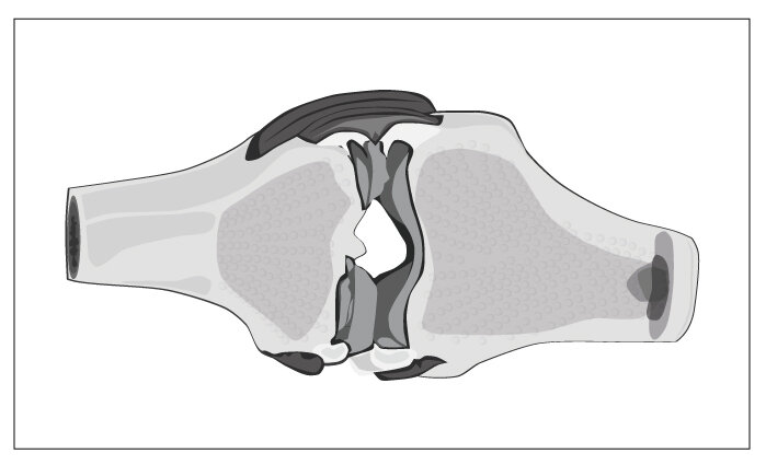 BE1287_Schmerzen-im-Knie__ST_Längsschnitt.jpg