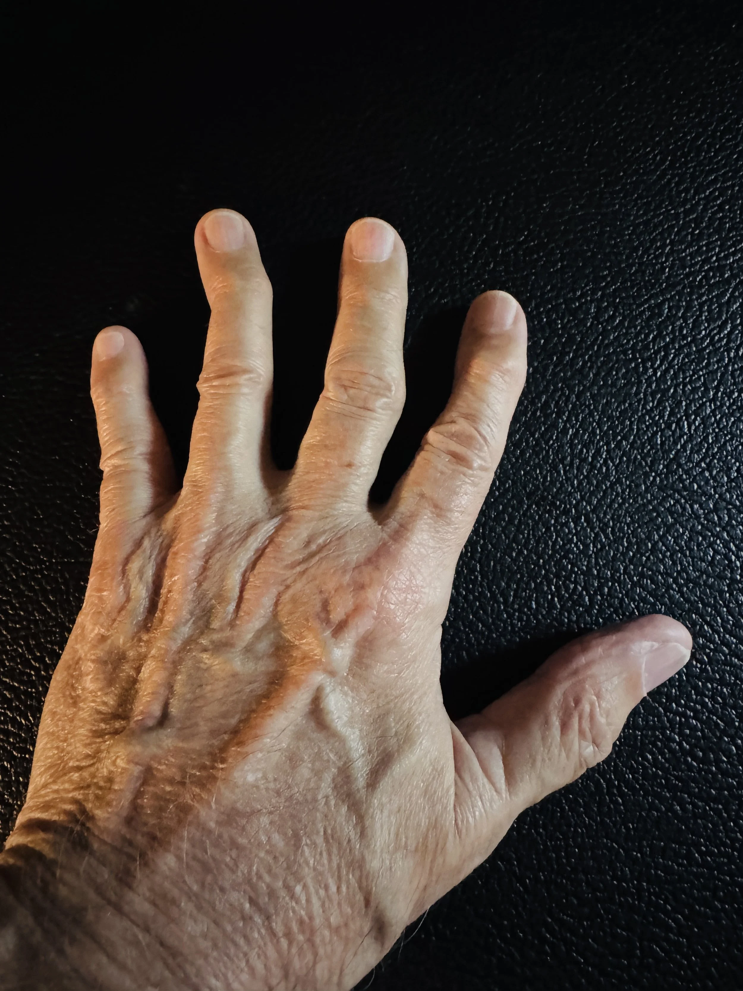My Hands Look Like Keith Richards'. I'm Still Playing.