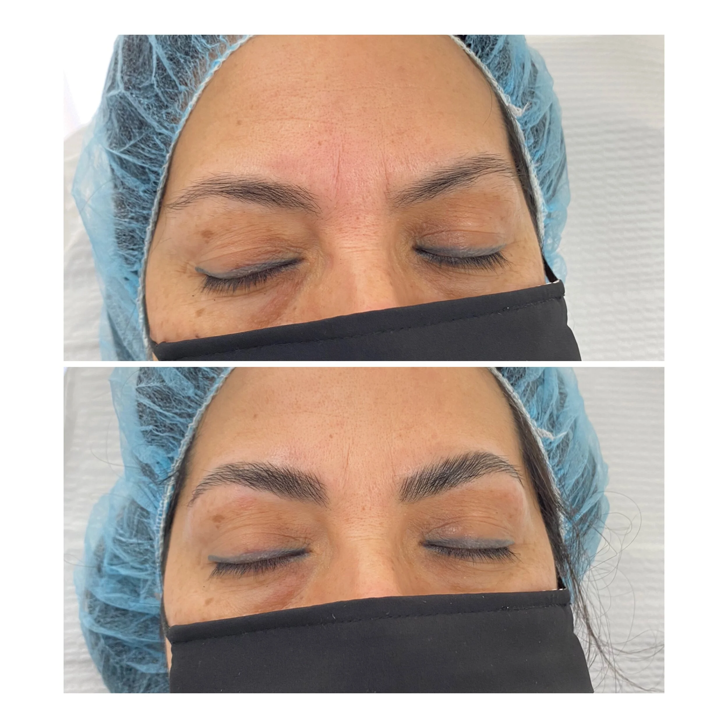 Brow Lamination at SkinLab Jupiter