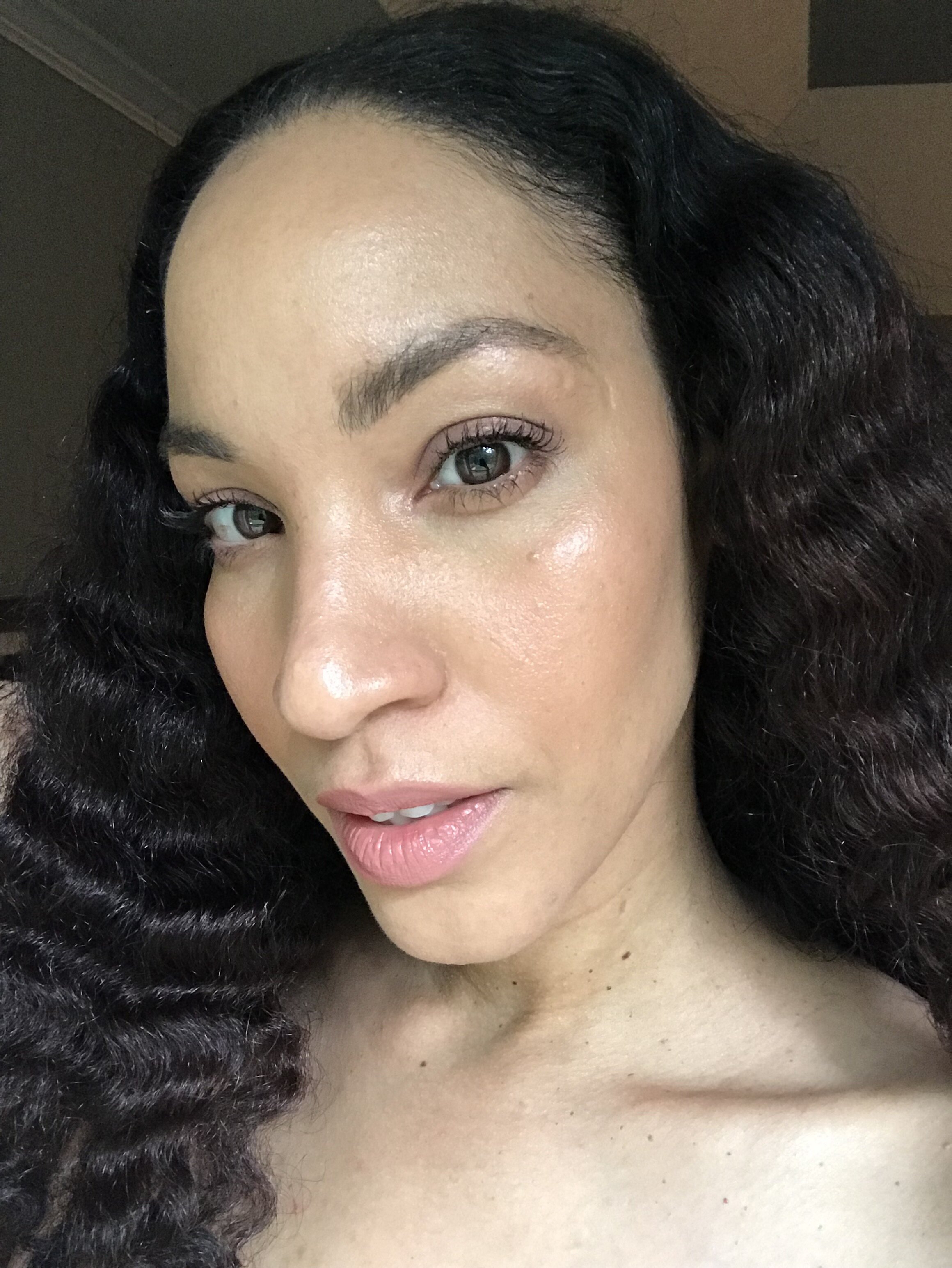 How I cured my fungal acne — with Saj