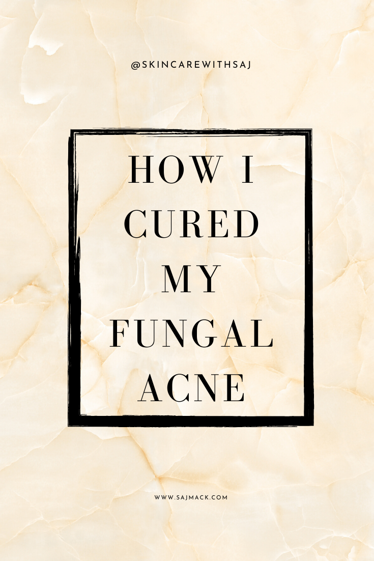 How I cured my fungal acne —with Saj