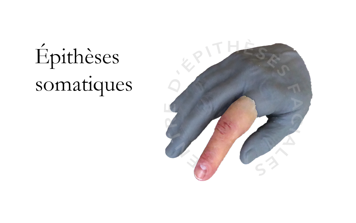 Acceuil Epithese Somatiques 3.png