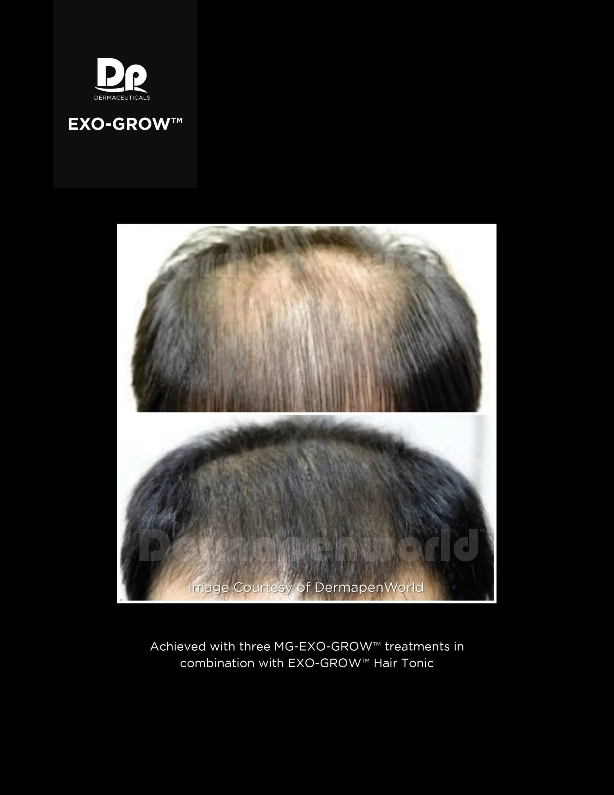 Exo-Grow pic 5.jpeg