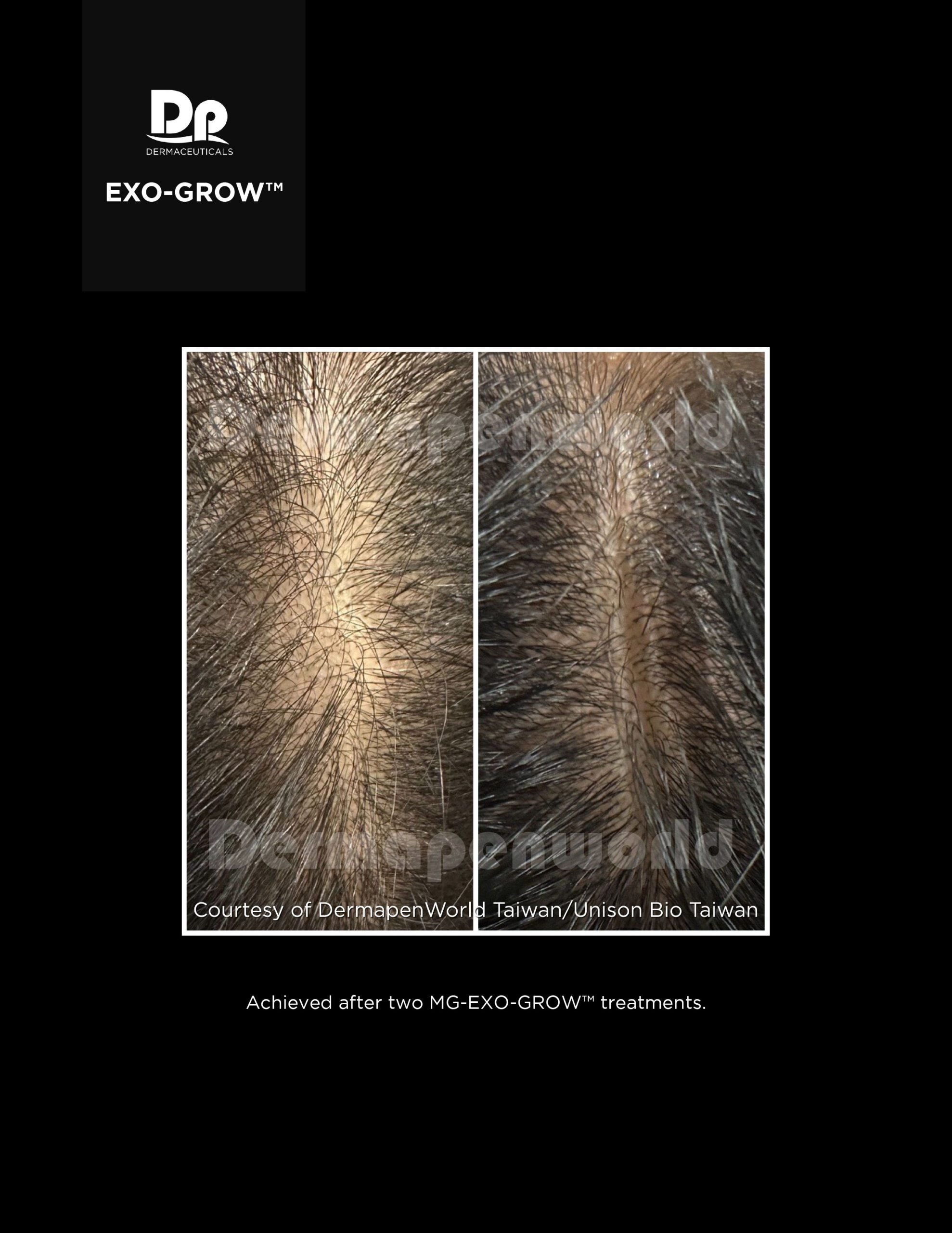 Exo-Grow Pic 6.jpeg