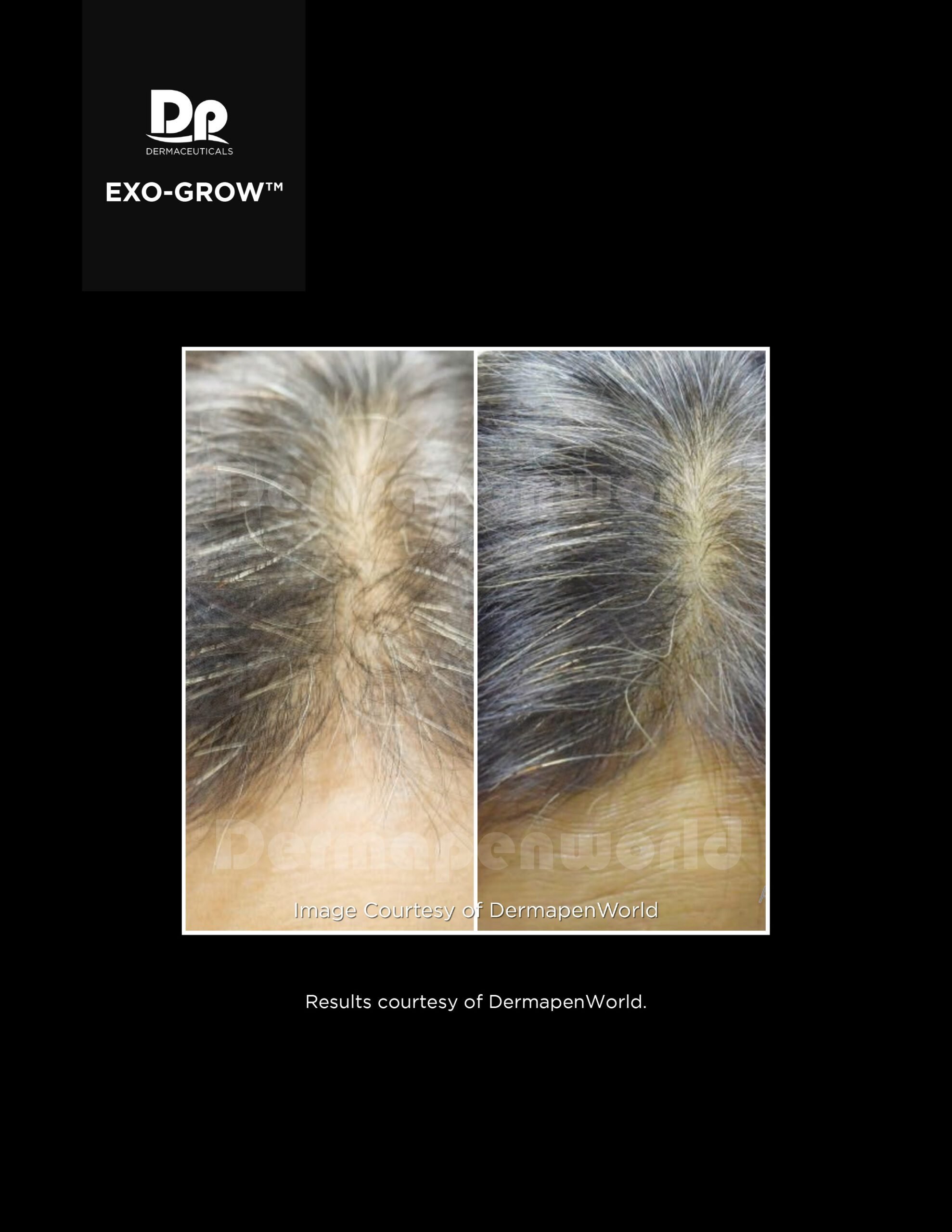 Exo-Grow pic 4.jpeg