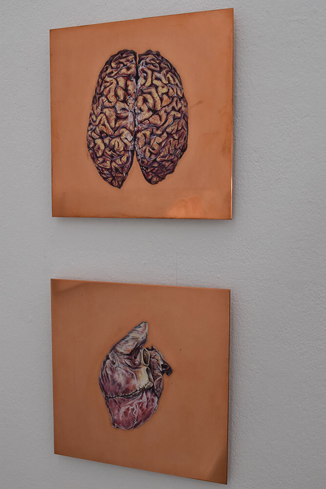 Brain - Progressive Paralysis, 59 years, male / 2007 - 2008 / scale 1:1 / oil on copper, 25 x 25 cm Heart - metabolic disorder, jelly atrophy of the subepicardial fat tissue, 53 years, female / 2008 