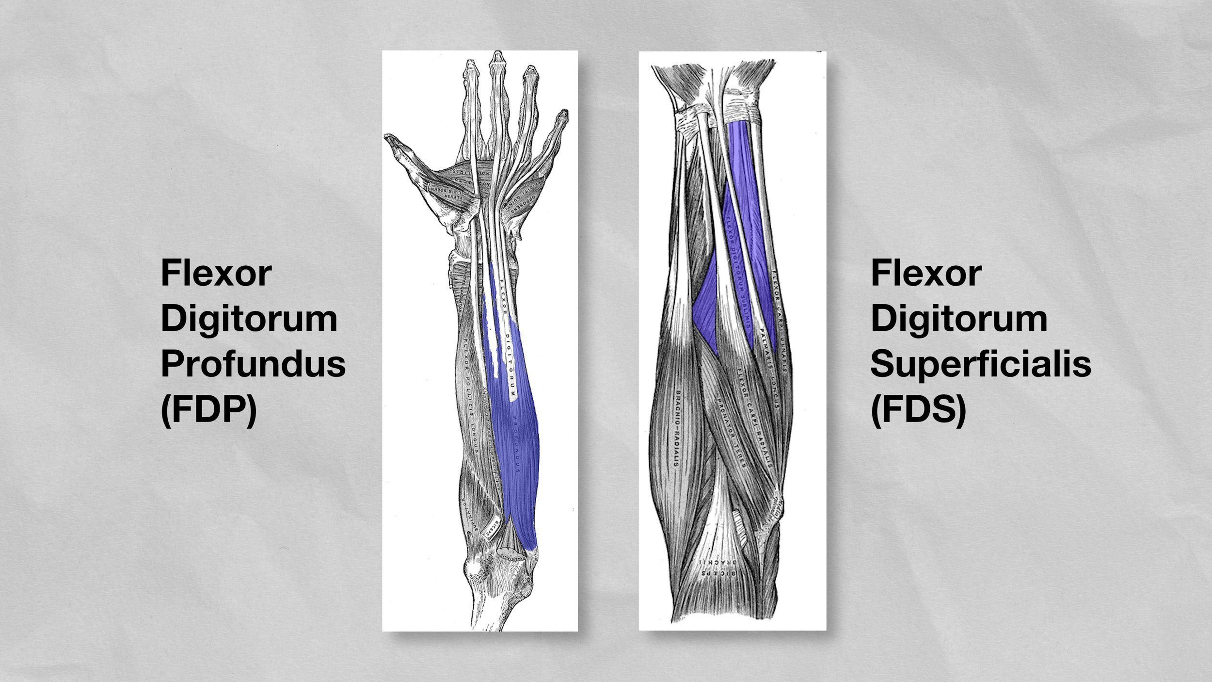 HoopersBeta_Ep118_FlexorTenosynovitis_EmileModesitt_11062022.00_01_21_17.Still008.jpg