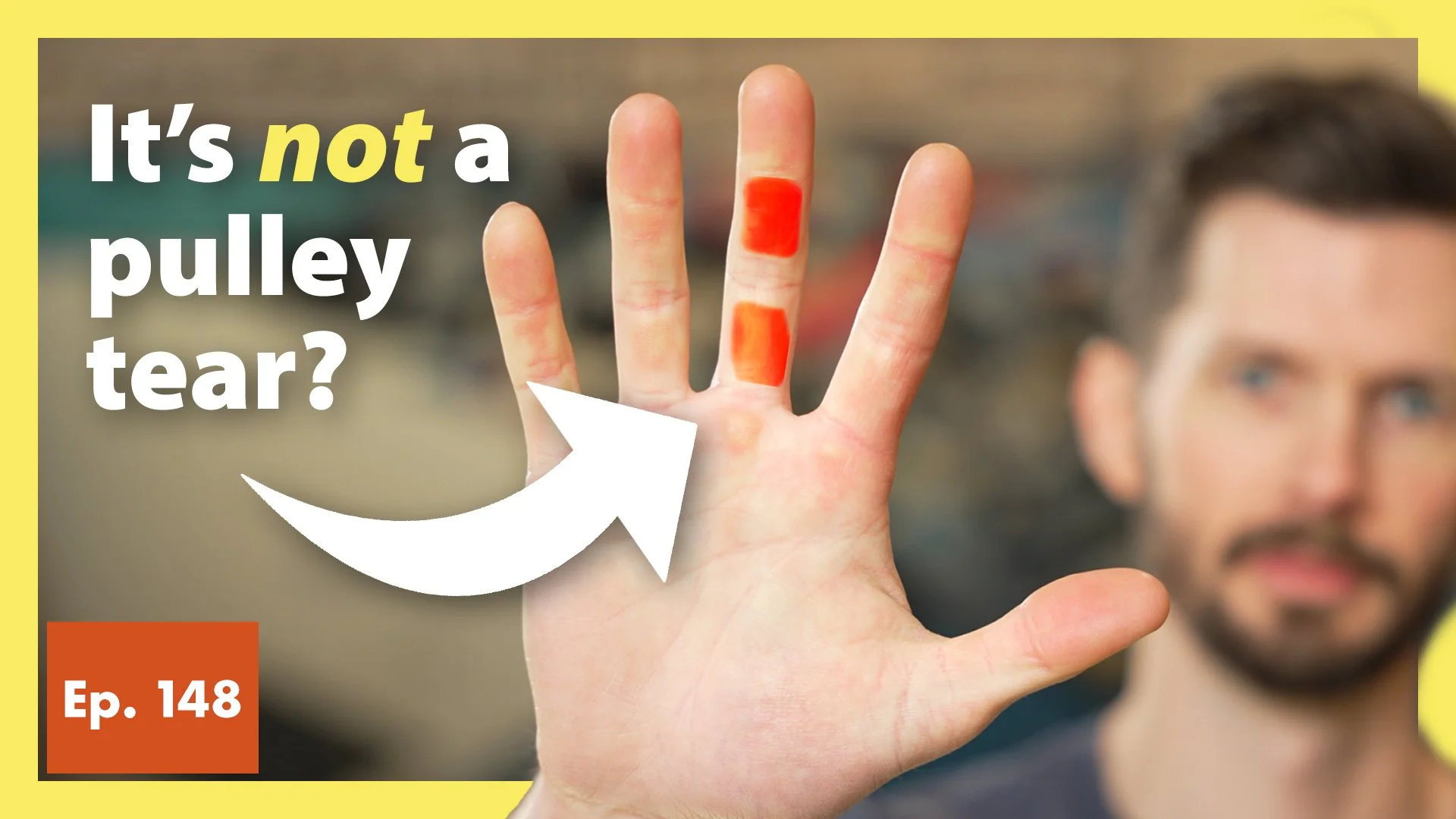 Library — Hooper's Beta