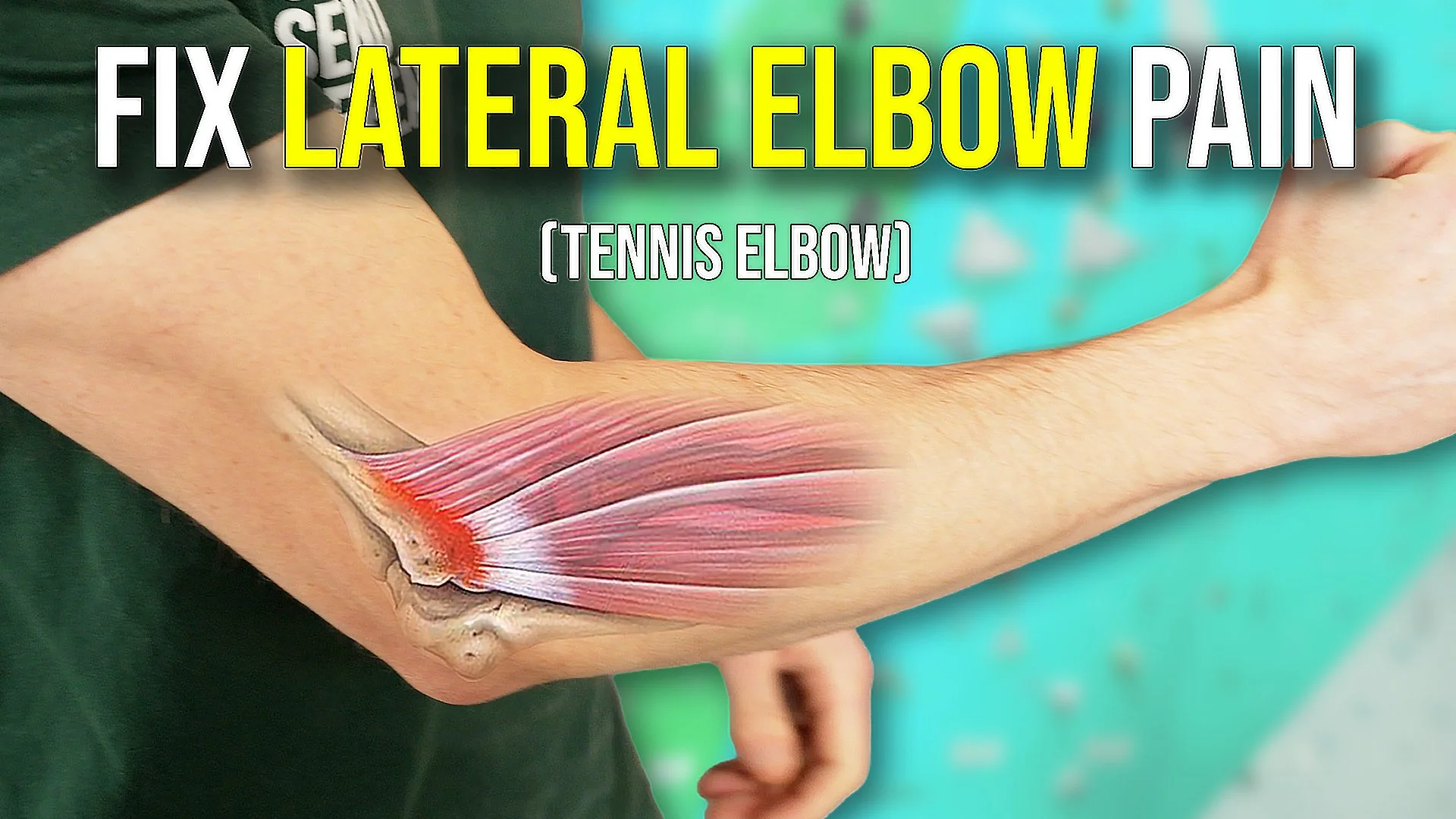 How to Fix Lateral Elbow Pain (Tennis Elbow)