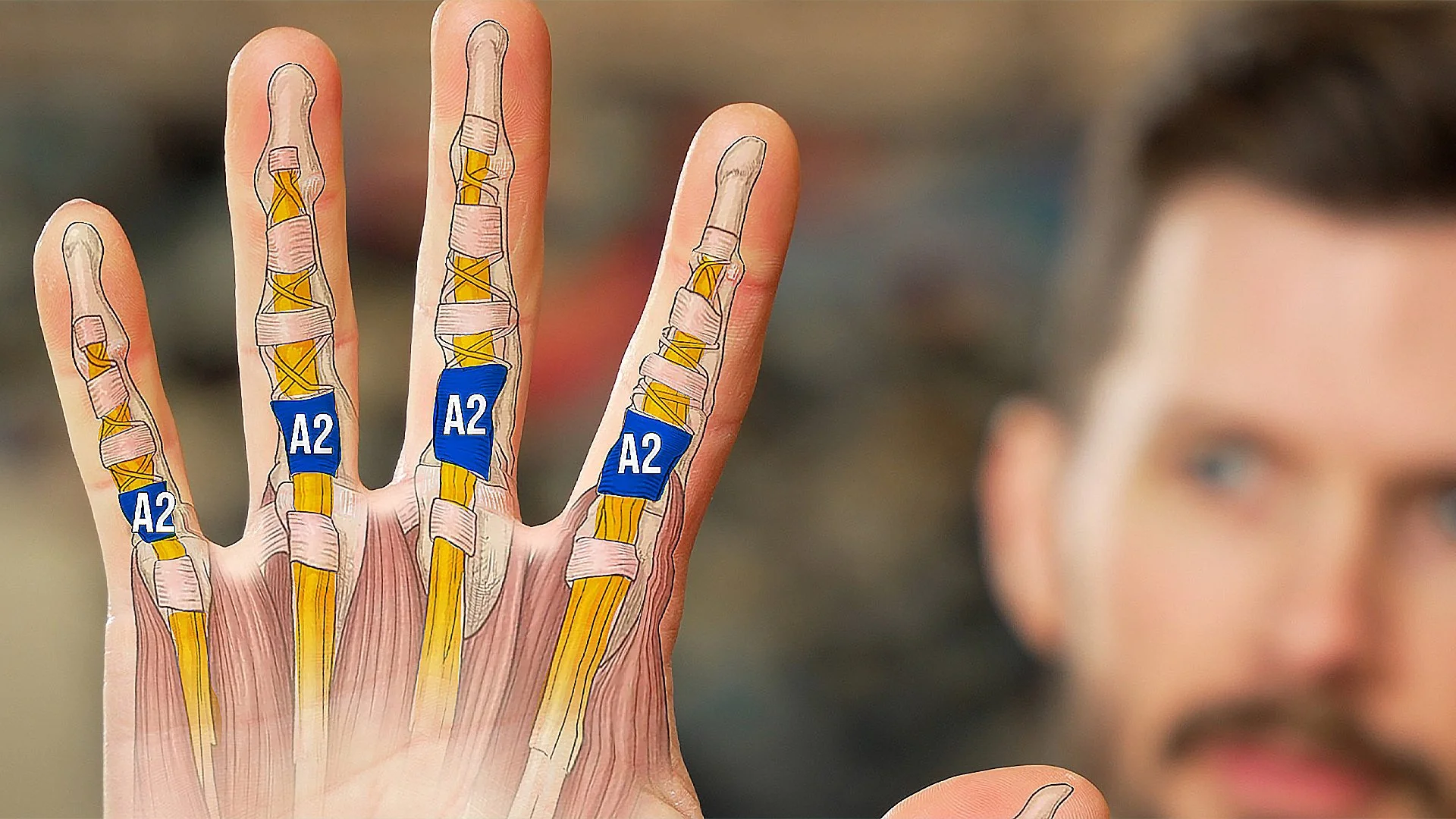 Ultimate A2 Pulley Injury Recovery Guide (PT's Full Protocol)