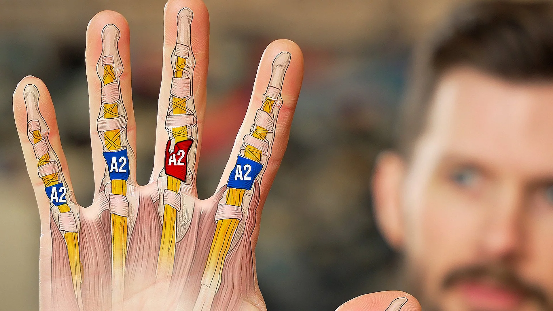 Ultimate A2 Pulley Injury Recovery Guide (PT's Full Protocol)