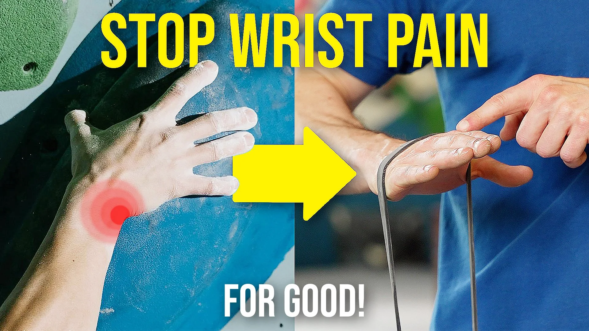 How to Fix Ulnar Wrist Pain (TFCC Injury Recovery Guide)