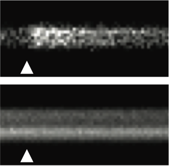 Proteostasis &amp; synaptic homeostasis What are the links between proteostasis and homeostatic plasticity? Learn more
